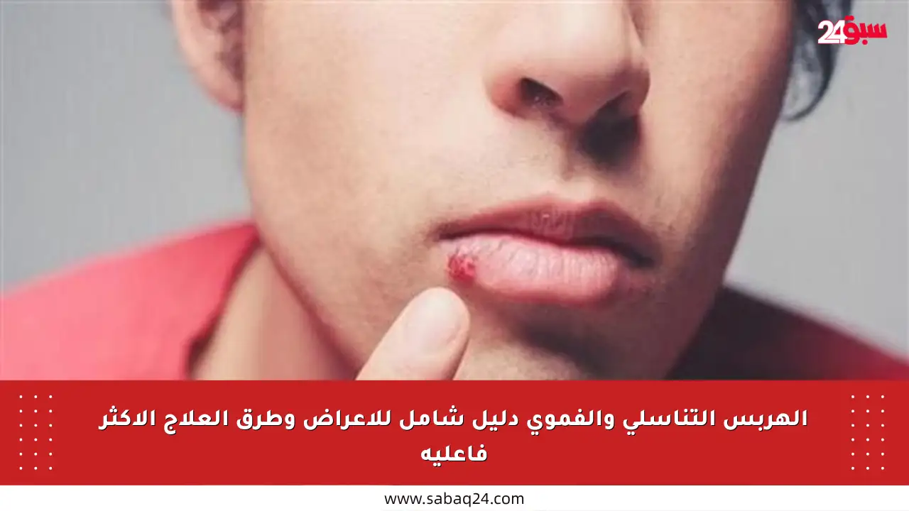 الهربس التناسلي والفموي دليل شامل للأعراض وطرق العلاج الأكثر فاعلية